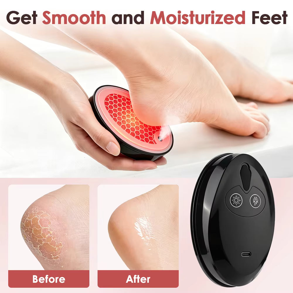 LumaFoot Hydrating Callus Remover – Rechargeable Pedicure Tool