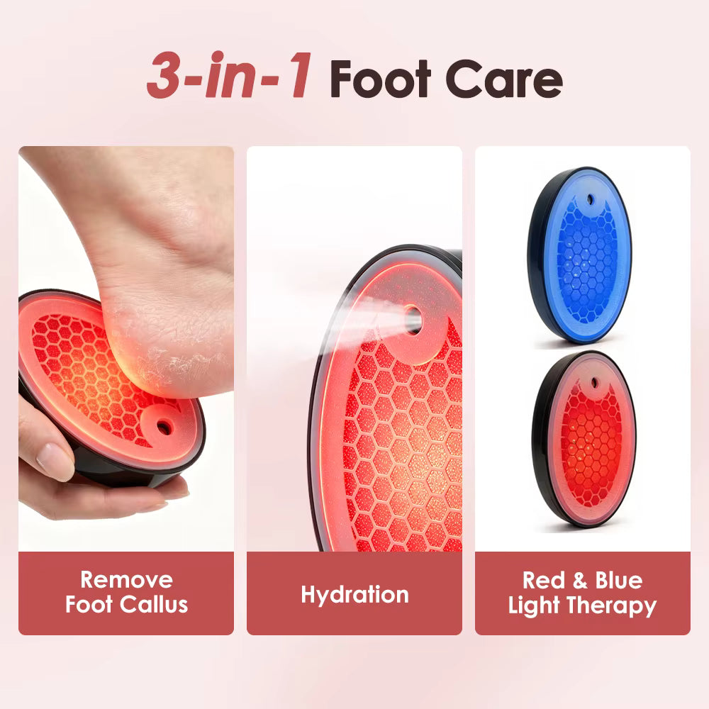 LumaFoot Hydrating Callus Remover – Rechargeable Pedicure Tool