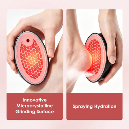 LumaFoot Hydrating Callus Remover – Rechargeable Pedicure Tool