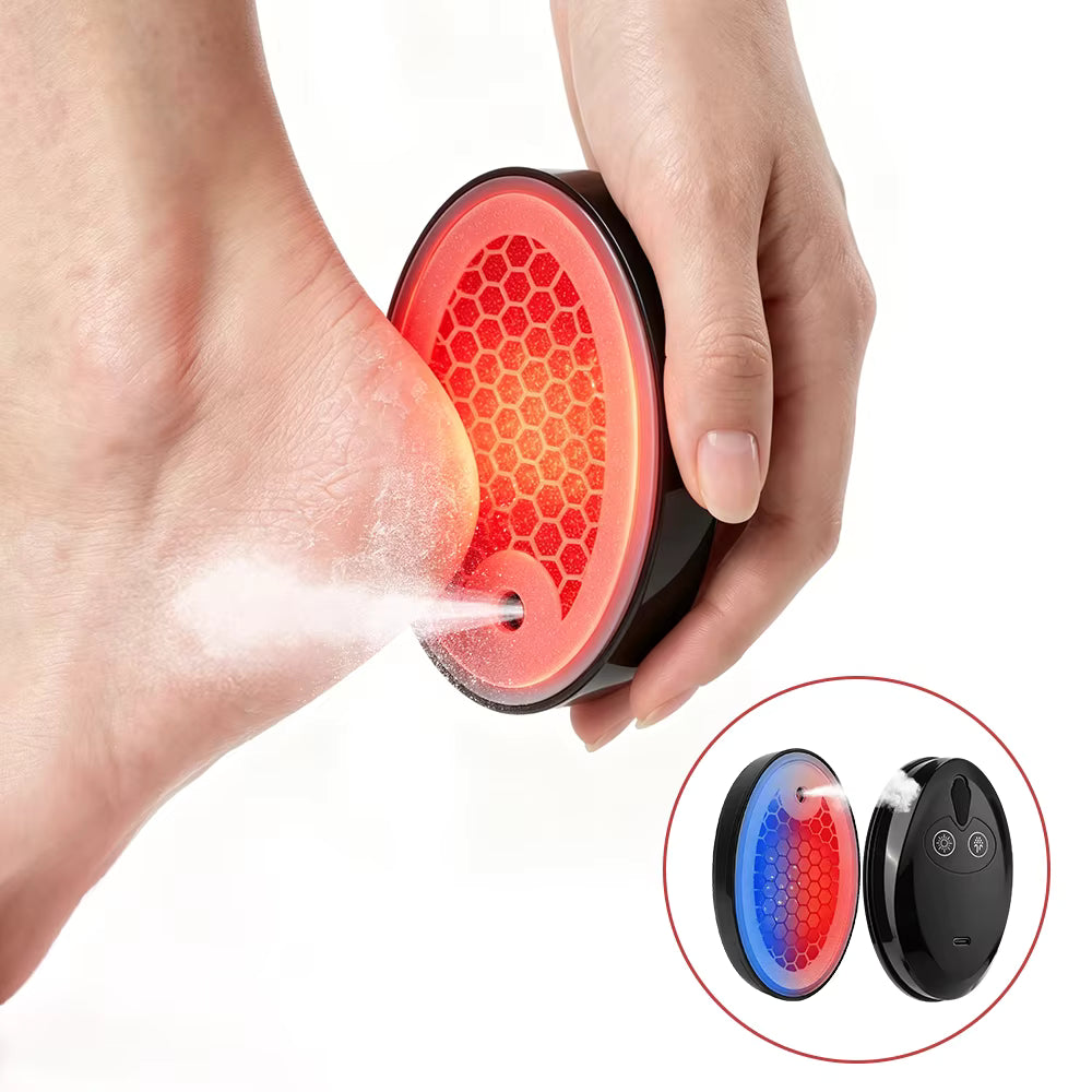LumaFoot Hydrating Callus Remover – Rechargeable Pedicure Tool