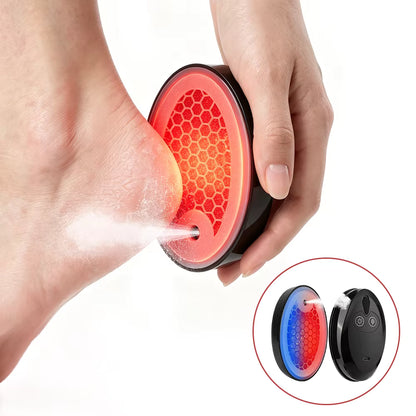 LumaFoot Hydrating Callus Remover – Rechargeable Pedicure Tool
